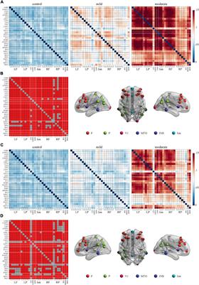 Repetitive Transcranial Magnetic Stimulation of the Dorsolateral Prefrontal Cortex Modulates Electroencephalographic Functional Connectivity in Alzheimer’s Disease